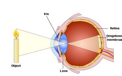 Multifocale Bifocale Implantlenzen